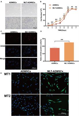 Melatonin Promotes the Therapeutic Effect of Mesenchymal Stem Cells on Type 2 Diabetes Mellitus by Regulating TGF-β Pathway